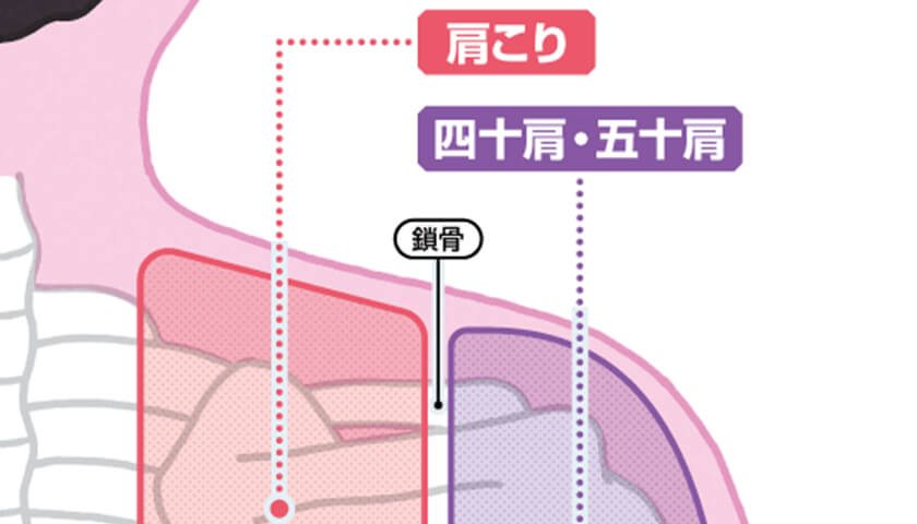 �����ꡦ�ͽ����ġ�[�ǿ���]���ȥ�֥�β��ˡ